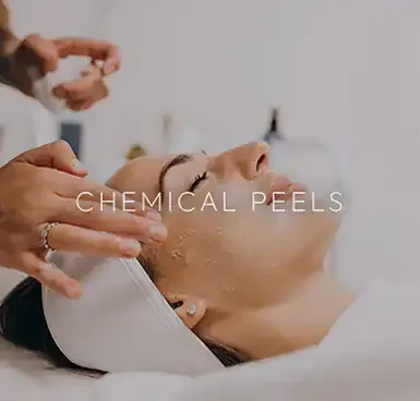 A clinician applying a chemical peel treatment to a patient’s face, captioned "Chemical Peels."