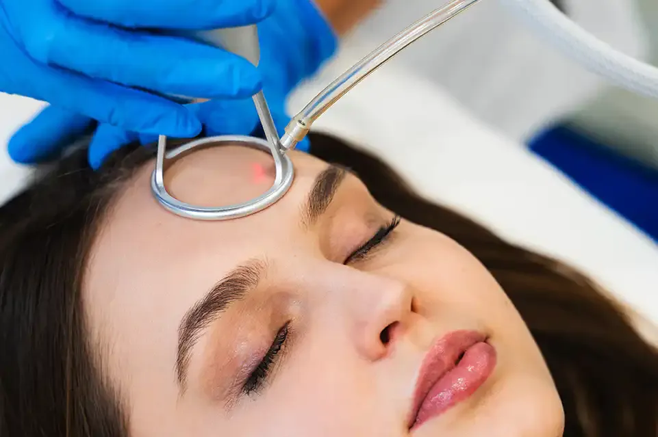CO2 fractional laser treatment