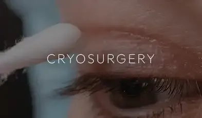 A clinician applying a cryosurgery treatment to a patient’s eye area, captioned "Cryosurgery."