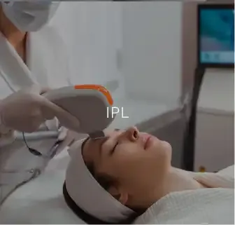 A patient reclined during an IPL (intense pulsed light) treatment, captioned "IPL."