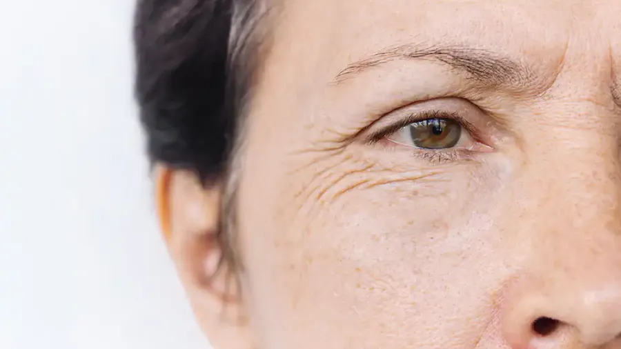 Close-up of an older woman's face showing fine lines and wrinkles around the eye